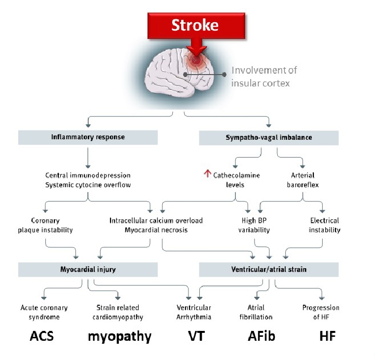 stroke-as-interdisciplinary-disease-what-the-practising-cardiologist